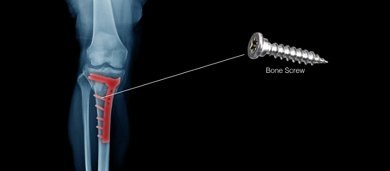 走心机加工骨钉.png 走心机加工骨钉.png